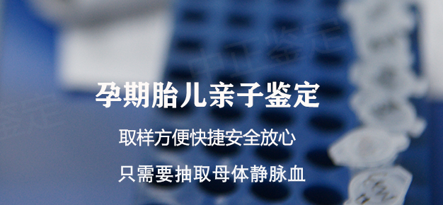 刚怀孕福州如何办理产前亲子鉴定,福州做怀孕亲子鉴定结果到底准不准确