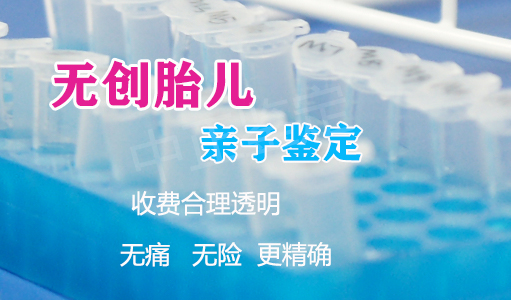 福州怀孕五周如何办理DNA亲子鉴定,福州孕期亲子鉴定多少钱